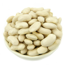 Hot selling select white kidney beans